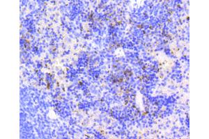 Immunohistochemistry of paraffin-embedded mouse spleen using MKI67 antibody (ABIN5997055) at dilution of 1/100 (40x lens).