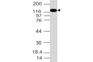 Image no. 1 for anti-Formin-Like 2 (FMNL2) (AA 1-321) antibody (ABIN5027206) (FMNL2 antibody  (AA 1-321))