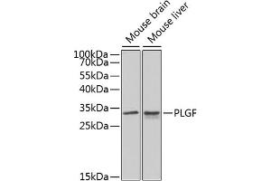 Western blot analysis of extracts of various cell lines, using PLGF antibody (ABIN3015554, ABIN3015555, ABIN3015556 and ABIN6218826) at 1:1000 dilution.