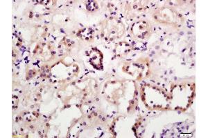 Formalin-fixed and paraffin embedded human kidney labeled with Anti-A4GALT Polyclonal Antibody, Unconjugated (ABIN873268) at 1:200 followed by conjugation to the secondary antibody and DAB staining (A4GALT antibody  (AA 291-353))