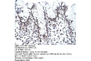 Human Stomach (PHF1 antibody  (C-Term))