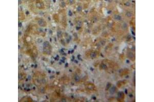 #VALUE! (IL-17 antibody  (AA 20-155))