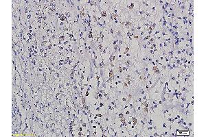 Formalin-fixed and paraffin embedded rat intestine labeled with Anti HOXB8 Polyclonal Antibody, Unconjugated (ABIN717776) followed by conjugation to the secondary antibody and DAB staining