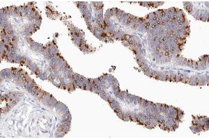 ABIN6267583 at 1/200 staining human Fallopian tube tissue sections by IHC-P. (NFKB2 antibody  (pSer870))