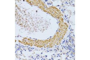 Immunohistochemistry (Paraffin-embedded Sections) (IHC (p)) image for anti-Cytochrome C, Somatic (CYCS) (AA 1-105) antibody (ABIN6139304)