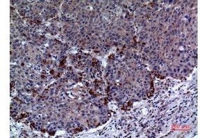 Immunohistochemistry (IHC) analysis of paraffin-embedded Human Lung, antibody was diluted at 1:100. (Periaxin antibody  (Internal Region))