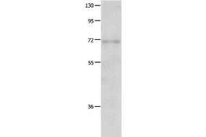 Western Blot analysis of Human fetal lung tissue using IGF2BP1 Polyclonal Antibody at dilution of 1:500 (IGF2BP1 antibody)