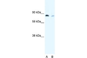 WB Suggested Anti-NFKB2 Antibody Titration:  0. (NFKB2 antibody  (N-Term))