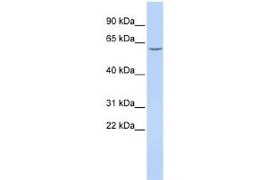 WB Suggested Anti-CES7 Antibody Titration:  0.