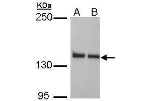 WB Image Sample (30 ug of whole cell lysate) A: H1299 B: HeLa 5% SDS PAGE antibody diluted at 1:1000