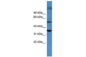 WB Suggested Anti-CYP11B1 Antibody Titration: 0. (CYP11B1 antibody  (Middle Region))