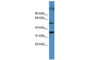 WB Suggested Anti-CYP11B1 Antibody Titration: 0.