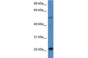 Image no. 1 for anti-Interleukin 18 (IL18) (C-Term) antibody (ABIN6746899) (IL-18 antibody  (C-Term))