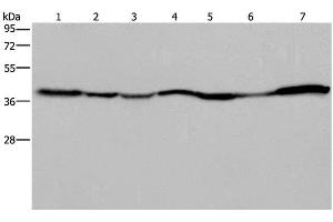 Western Blot analysis of 293T and Hela cell, Human fetal liver, Mouse spleen and heart tissue, Human fetal brain and hepatocellular carcinoma tissue using GOT2 Polyclonal Antibody at dilution of 1:400 (GOT2 antibody)