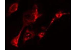 ABIN6275460 staining  HeLa cells by IF/ICC. (RAB20 antibody  (Internal Region))