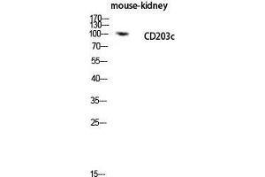 Western Blot (WB) analysis of Mouse Kidney lysis using CD203c antibody. (ENPP3 antibody  (Internal Region))