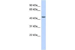 WB Suggested Anti-OGDH Antibody Titration: 0. (alpha KGDHC antibody  (N-Term))
