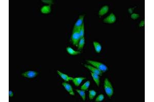 Immunofluorescent analysis of Hela cells using ABIN7148658 at dilution of 1:100 and Alexa Fluor 488-congugated AffiniPure Goat Anti-Rabbit IgG(H+L) (CKB antibody  (AA 2-270))