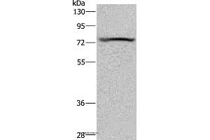 Western blot analysis of Mouse heart tissue, using KCNQ1 Polyclonal Antibody at dilution of 1:200 (KCNQ1 antibody)