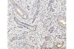 IHC analysis of MOV10 using anti-MOV10 antibody (ABIN7600236). (MOV10 antibody  (AA 167-772))