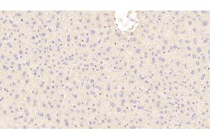 Immunohistochemistry (IHC) image for anti-beta-2-Microglobulin (B2M) (AA 22-119) antibody (ABIN7429223)