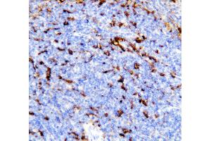 Anti-TREM1 antibody, IHC(P) IHC(P): Mouse Spleen Tissue (TREM1 antibody  (AA 74-90))