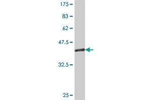 Western Blot detection against Immunogen (35. (RGS5 antibody  (AA 94-181))