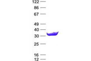 Validation with Western Blot (SARNP Protein (His tag))
