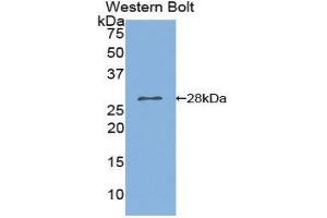 Western Blotting (WB) image for anti-Phospholipase A2, Group VI (Cytosolic, Calcium-Independent) (PLA2G6) (AA 481-702) antibody (ABIN1859465) (PLA2G6 antibody  (AA 481-702))