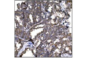 IHC analysis of Caspase-9/CASP9 using anti-Caspase-9/CASP9 antibody (ABIN7600340). (Caspase 9 antibody  (AA 18-416))