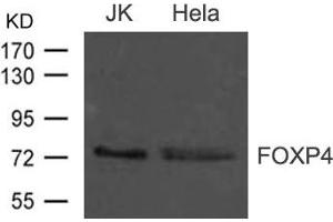 Western blot analysis of extract from JK and Hela cells using FOXP4 Antibody
