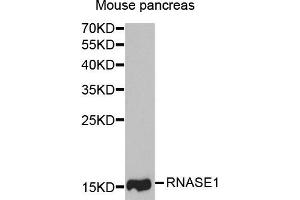 Western Blotting (WB) image for anti-Ribonuclease, RNase A Family, 1 (Pancreatic) (RNASE1) antibody (ABIN1882329) (RNASE1 antibody)