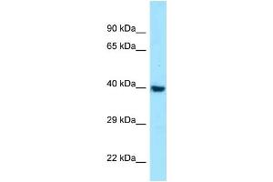 WB Suggested Anti-MC1R Antibody Titration: 1. (MC1 Receptor antibody  (C-Term))