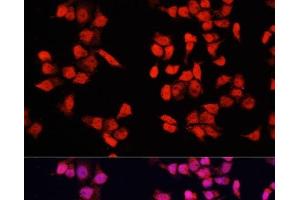 Immunofluorescence analysis of HeLa cells using YBX1 Polyclonal Antibody at dilution of 1:100. (YBX1 antibody)