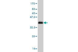 Western Blot detection against Immunogen (36. (CSNK1G1 antibody  (AA 293-393))