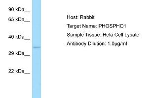 Host: RabbitTarget Name: PHOSPHO1Antibody Dilution: 1. (PHOSPHO1 antibody  (C-Term))