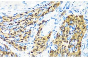 Immunohistochemistry of paraffin-embedded Rat ovary using KMT2E Polyclonal Antibody at dilution of 1:200 (40x lens). (MLL5/KMT2E antibody)