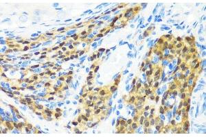 Immunohistochemistry of paraffin-embedded Rat ovary using KMT2E Polyclonal Antibody at dilution of 1:200 (40x lens).