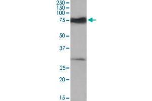 Nmnat3 polyclonal antibody  (0.