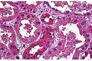 Human Kidney: Formalin-Fixed, Paraffin-Embedded (FFPE) (ERBB3 antibody  (AA 1-131))