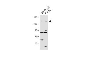 All lanes : Anti-TNIK Antibody at 1:1000 dilution Lane 1: COLO 205 whole cell lysate Lane 2:Caco2 whole cell lysate Lysates/proteins at 20 μg per lane. (TNIK antibody  (Ser764))