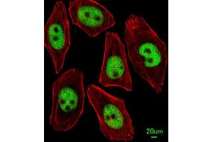 Immunofluorescent analysis of  cells, using KLF4 Antibody f. (KLF4 antibody  (AA 481-504))