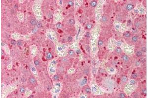 Human Liver (formalin-fixed, paraffin-embedded) stained with A2M antibody ABIN291670 at 2. (alpha 2 Macroglobulin antibody)