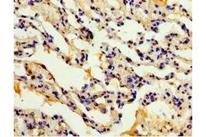 Immunohistochemistry of paraffin-embedded human lung tissue using ABIN7150056 at dilution of 1:100 (ADAM33 antibody  (AA 140-420))