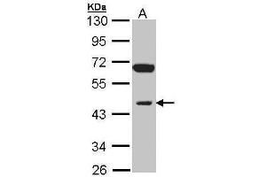 WB Image Sample (30 ug of whole cell lysate) A: Raji 10% SDS PAGE antibody diluted at 1:1000 (INPP1 antibody)