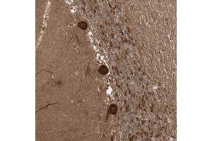 Immunohistochemical staining of human cerebellum with C10orf113 polyclonal antibody  shows strong cytoplasmic nucleolar positivity in Purkinje cells at 1:50-1:200 dilution. (C10orf113 antibody)