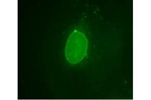 Image no. 2 for anti-Emerin (EMD) (AA 114-183) antibody (ABIN303590) (Emerin antibody  (AA 114-183))