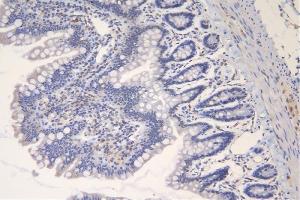 IHC analysis of TRAF6 using anti-TRAF6 antibody (ABIN7600026).