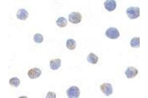 Immunocytochemistry of IKK alpha in Jurkat cells with AP30403PU-N IKK alpha antibody at 1μg/ml. (IKK alpha antibody  (C-Term))