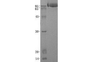 Validation with Western Blot (Vasn Protein (His tag))